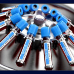 Doença crônica agravou situação de paciente com Covid em 87% dos óbitos