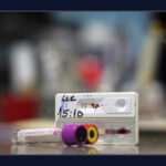 Análise da Fiocruz libera 300 mil kits de testes rápidos doados ao GDF