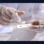 Todas as UBSs do DF voltam a oferecer testes rápidos